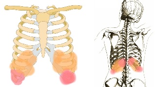 the back pain under ribs symptoms