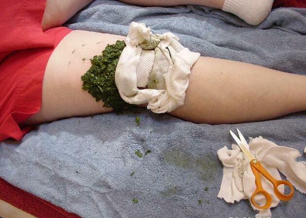 A warm compress of crushed cabbage leaves on an aching knee joint with osteoarthritis