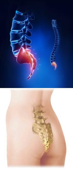 the back pain tailbone